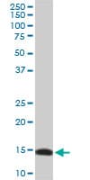 RPL36A / Ribosomal Protein L36 Antibody (clone 5F8)