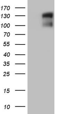 Monoclonal Mouse anti-Human GLI / GLI1 Antibody (clone OTI1B5, aa755-1106, WB)
