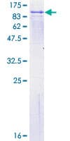 Human FPGT Protein (Recombinant GST)