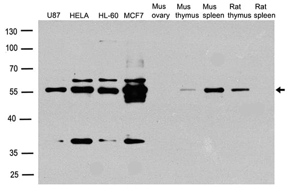 Polyclonal Rabbit anti-Human CCNA2 / Cyclin A2 Antibody (WB)