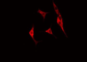 RPS8 / Ribosomal Protein S8 Antibody