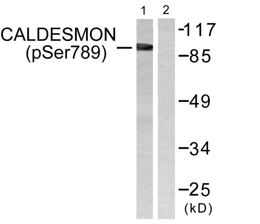 CALD1 / Caldesmon Antibody (phospho-Ser789)