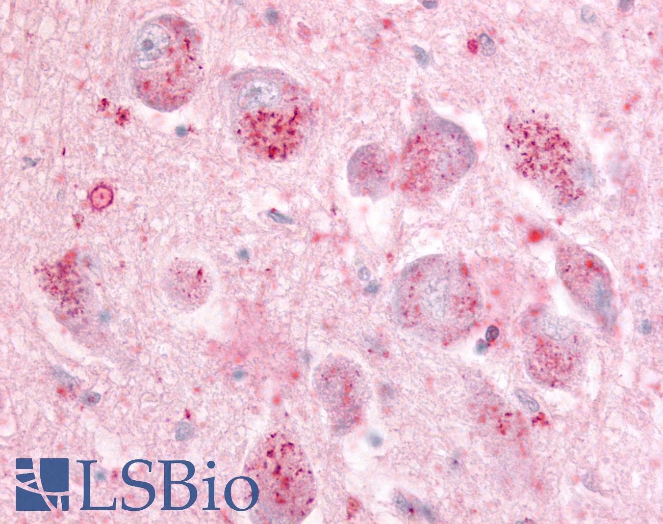 IHC-plus™ GPR21 Antibody (C-Terminus)
