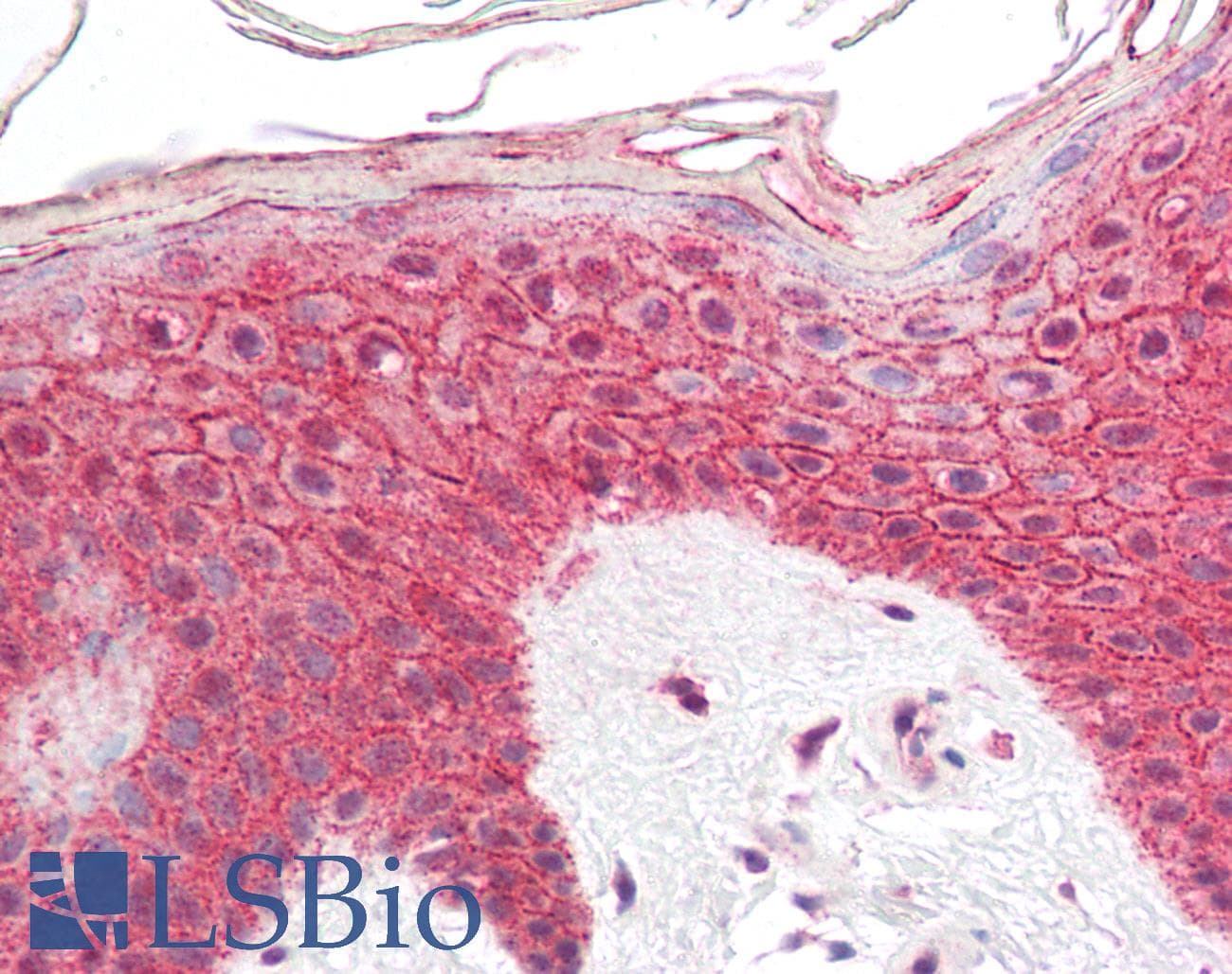 IHC-plus™ Polyclonal Rabbit anti-Human DSC2 / Desmocollin 2 Antibody (IHC, WB)