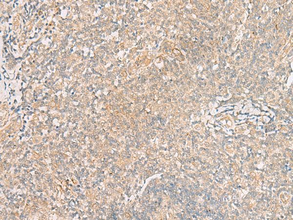 Polyclonal Rabbit anti-Human TRAF6 Antibody (IHC, WB)