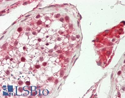 IHC-plus™ PARPBP / C12orf48 Antibody (aa522-550)