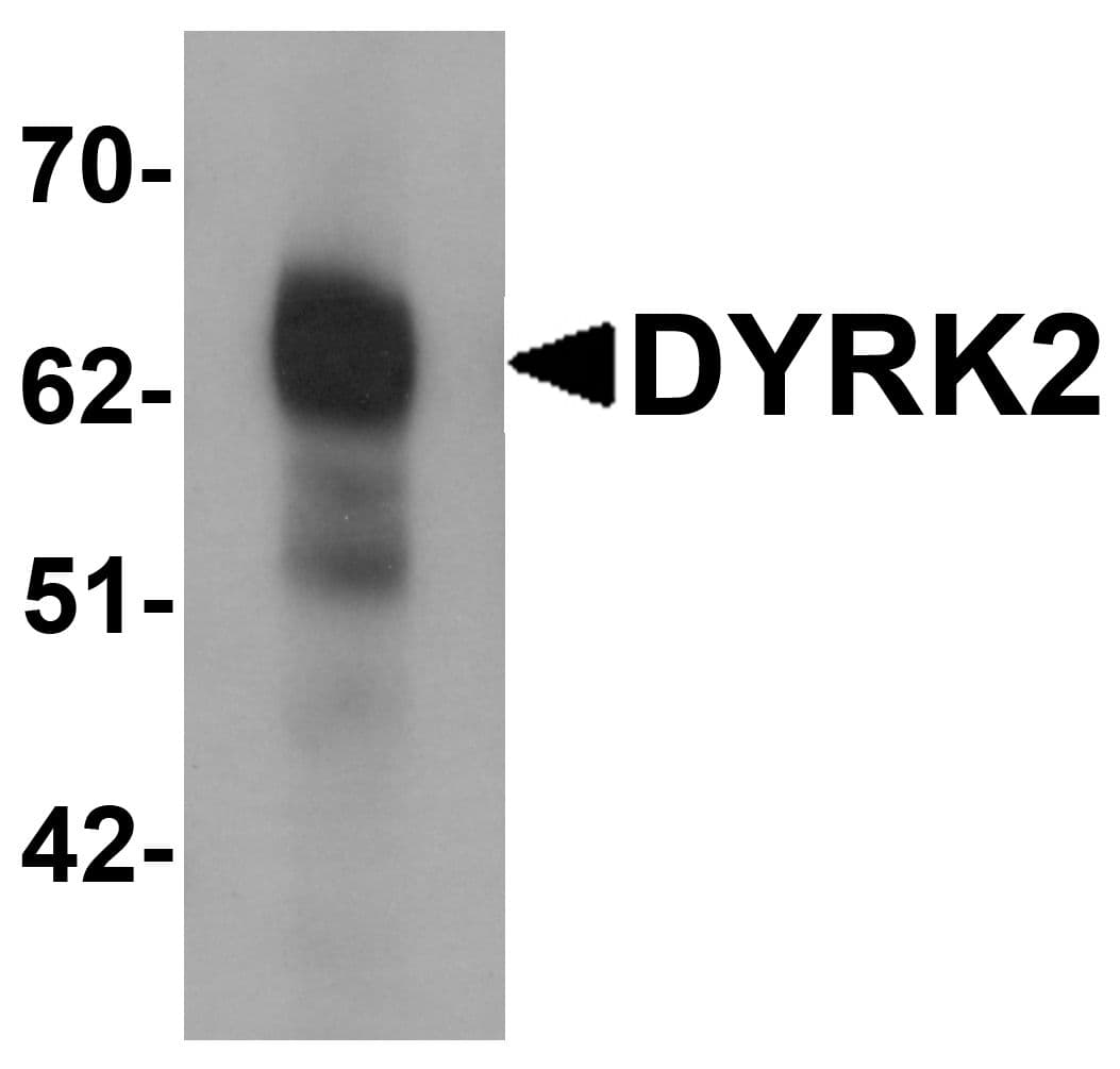 IHC-plus™ Polyclonal Rabbit anti-Human DYRK2 Antibody (IHC, IF, WB)