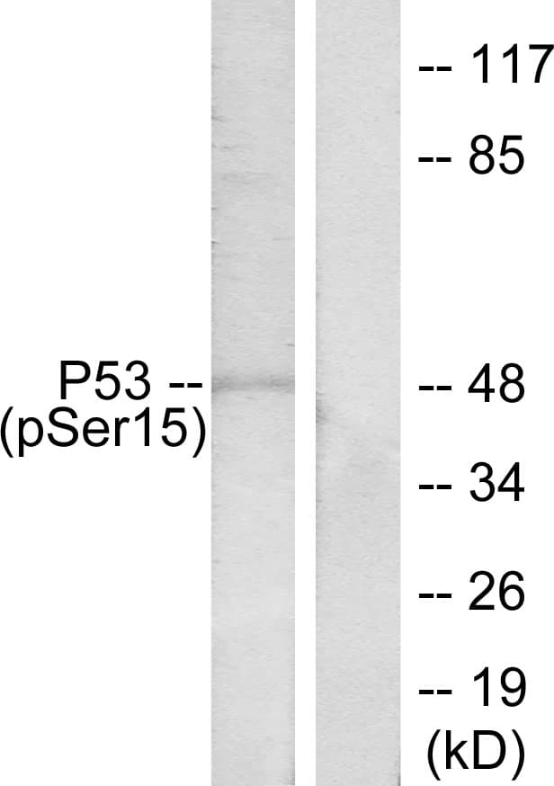 TP53 / p53 Antibody (phospho-Ser15)