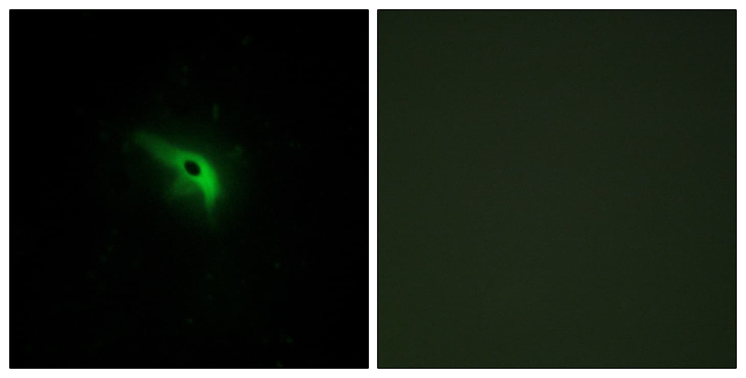 Polyclonal Rabbit anti-Human TP53AIP1 / p53 AIP1 Antibody (aa75-124, IHC, IF)