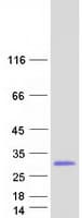 Human RHOC Protein (Recombinant Myc-DDK (Flag))