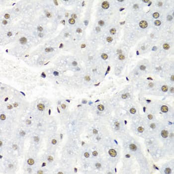 HNRNPR / hnRNP R Antibody