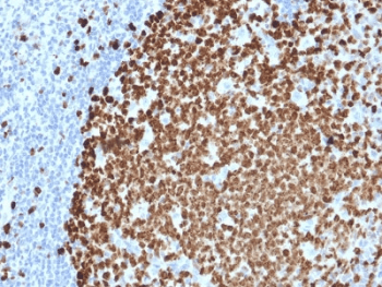 Monoclonal Mouse anti-Human MKI67 / Ki67 Antibody (clone MKI67/2461, Azide-free,BSA-free, IHC, IF)
