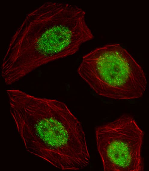 BLZF1 Antibody (aa156-184)