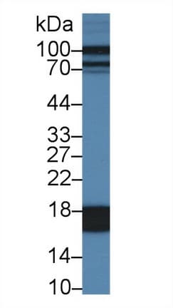 FABP1 / L-FABP Antibody (aa1-127)