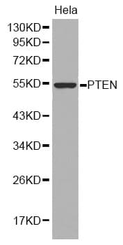 Polyclonal Rabbit anti-Human PTEN Antibody (IHC, WB)