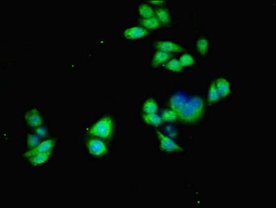 IHC-plus™ ALK2 / ACVR1 Antibody (aa20-125)