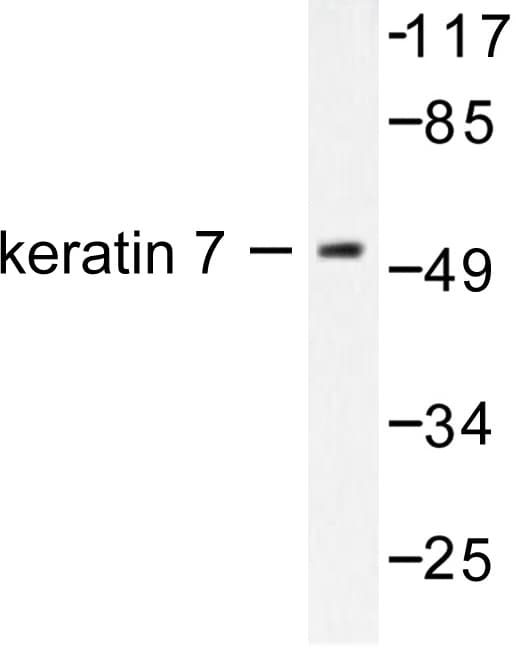 KRT7 / CK7 / Cytokeratin 7 Antibody (Leu451)