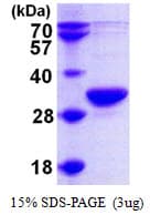 Human RPP30 Protein (Recombinant His)