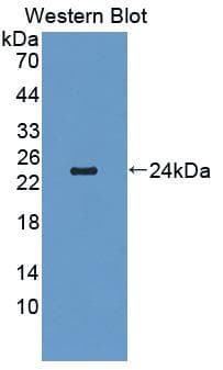 CDH2 / N Cadherin Antibody (aa45-238)
