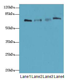 IHC-plus™ PGM2L1 Antibody