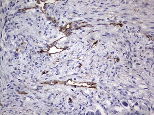 IHC-plus™ CDH4 / R Cadherin Antibody (aa170-428, clone 6H5)