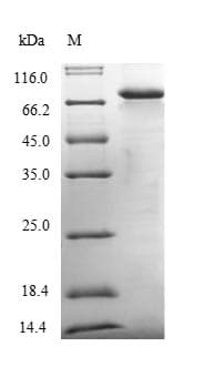 Human JCHAIN / Ig J Chain Protein (Recombinant 10His, N-terminus + Myc, C-terminus)