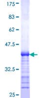 Human SLC12A6 / KCC3 Protein (Recombinant GST, N-terminus)