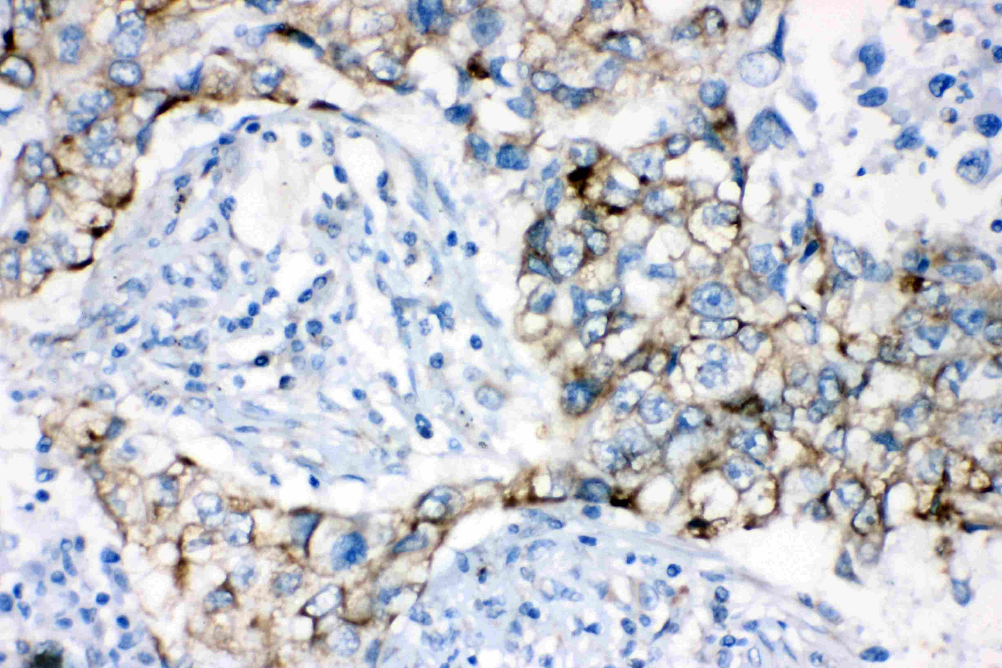 AK2 / Adenylate Kinase 2 Antibody