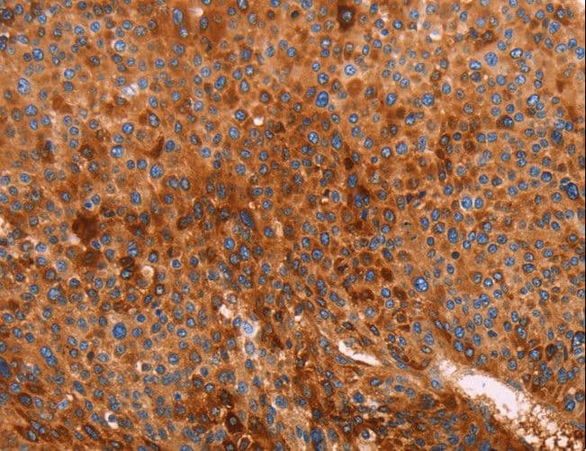 GC / Vitamin D-Binding Protein Antibody