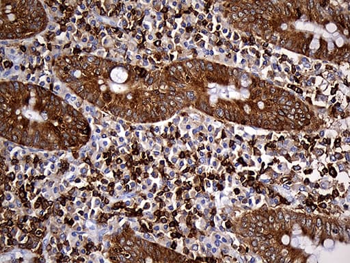 SH3BP1 Antibody (clone OTI2F4)