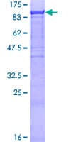 Human CHFR Protein (Recombinant GST)