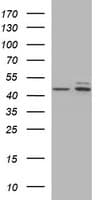 TUBB2B / Tubulin Beta 2B Antibody (clone OTI0C3)