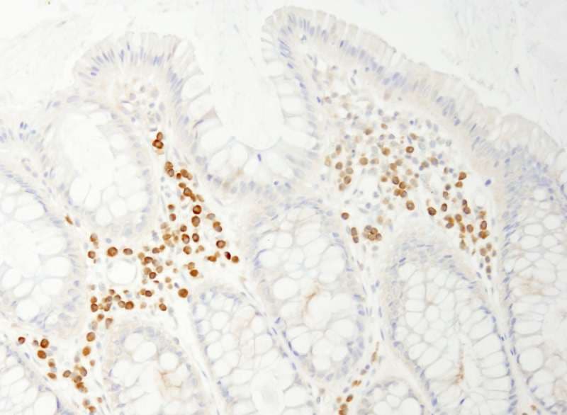 PABPC4 Antibody (aa594-644)
