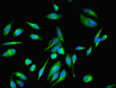 EEF1E1 / AIMP3 Antibody (aa2-174)