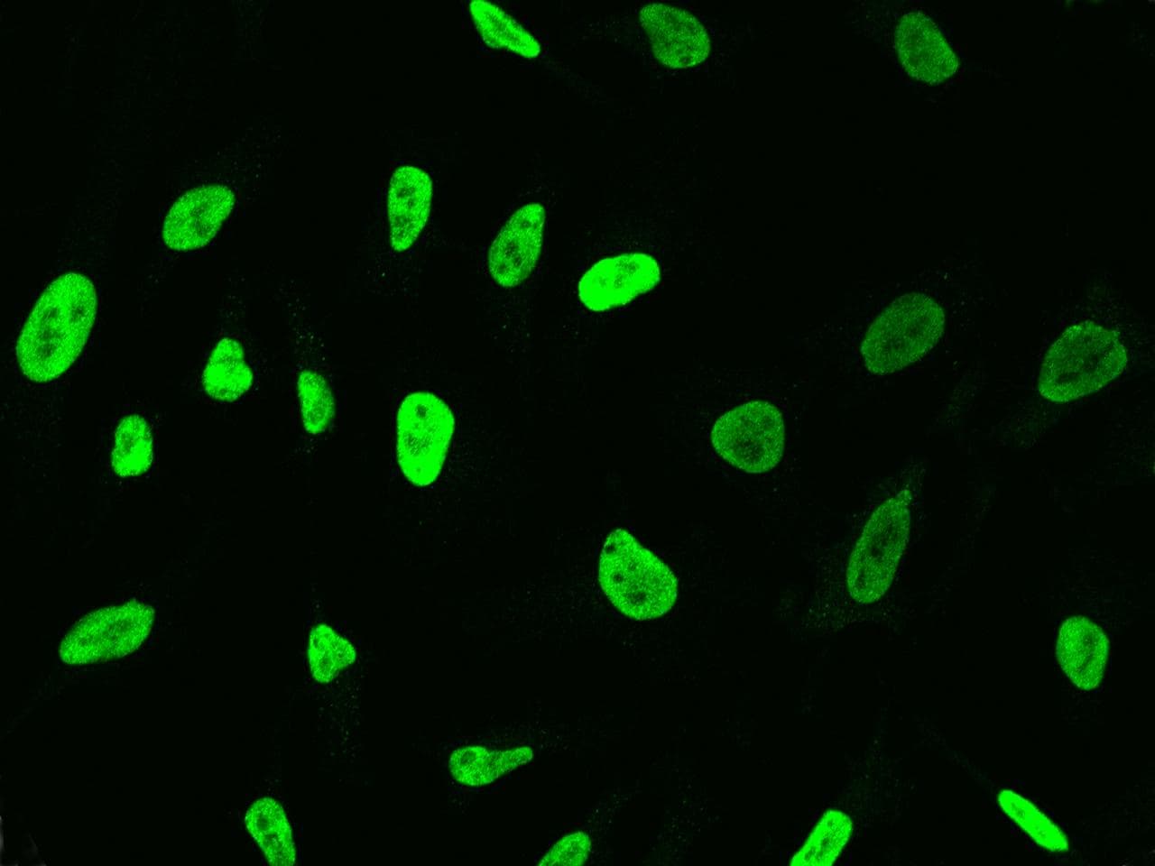 Polyclonal Rabbit anti-Human TKT / Transketolase Antibody (Preservative Free, IF, WB)