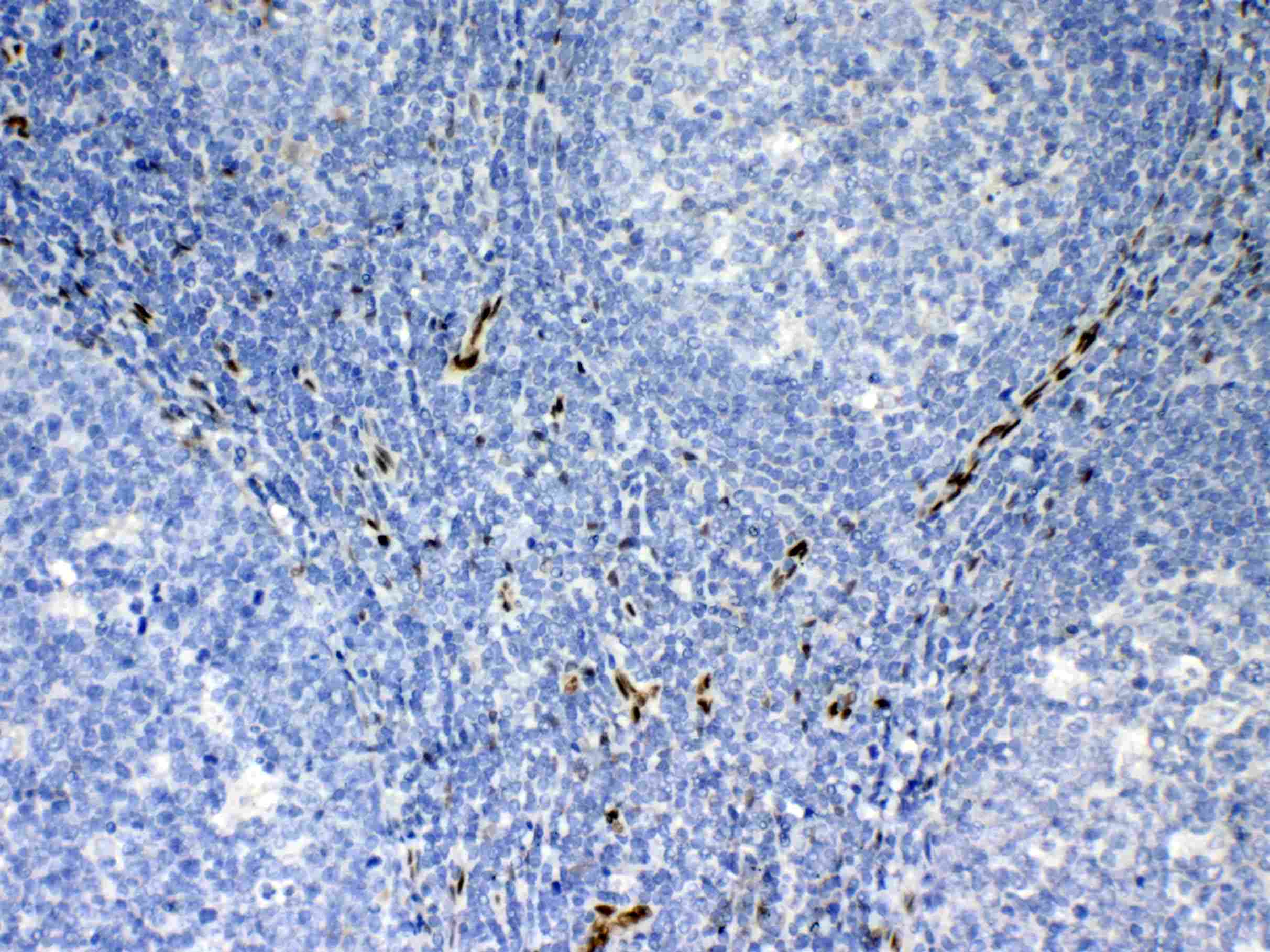 Polyclonal Goat anti-Human IL-33 Antibody (IHC, WB)
