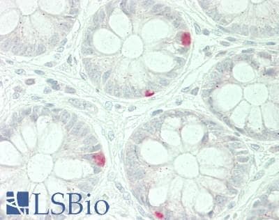 IHC-plus™ Polyclonal Rabbit anti-Human Gastric Inhibitory Peptide Antibody (IHC, WB)