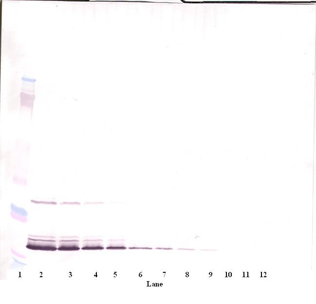 IFN Gamma / Interferon Gamma Antibody