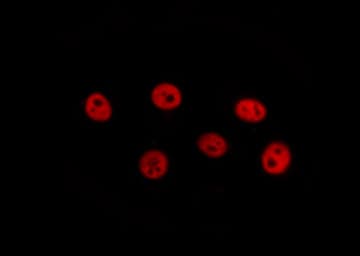 CBFB Antibody