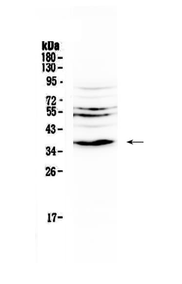 IL12B / IL12 p40 Antibody