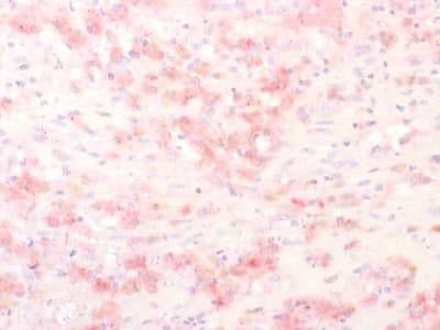 TYRP1 / gp75 Antibody (aa 257-377, clone TYRP1/2340R)