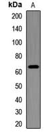 IMP-3 / IGF2BP3 Antibody