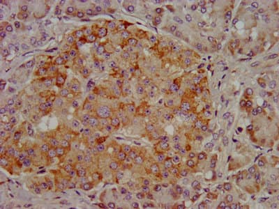 ARSE / Arylsulfatase E Antibody