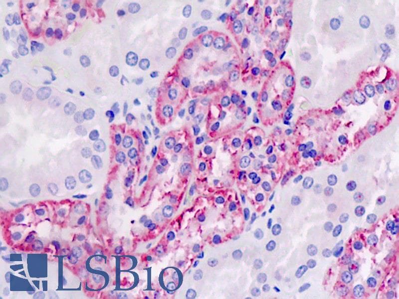 IHC-plus™ Polyclonal Rabbit anti-Human PLD4 / Phospholipase D4 Antibody (aa457-506, IHC, WB)