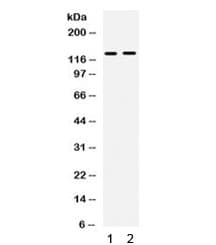 Polyclonal Rabbit anti-Human TRPM4 Antibody (IHC, WB)