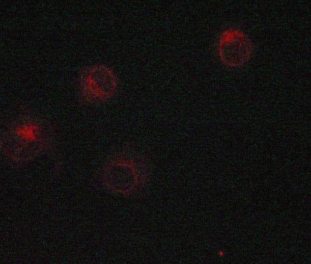 Polyclonal Rabbit anti-Human CTNNB1 / Beta Catenin Antibody (IHC, IF, WB)