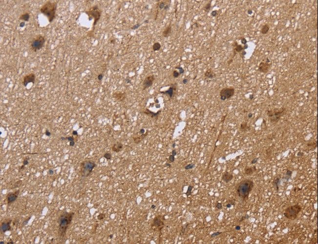 Polyclonal Rabbit anti-Human EXTL3 Antibody (IHC)