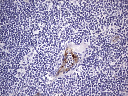 VWF / Von Willebrand Factor Antibody (aa764-1263, clone OTI7G3, Carrier-free)