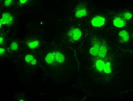 IHC-plus™ Monoclonal Mouse anti-Human SSB / La Antibody (clone 9D6, IHC, IF, WB)