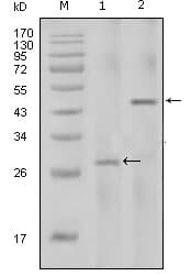 IL2 Antibody (clone 8D5)